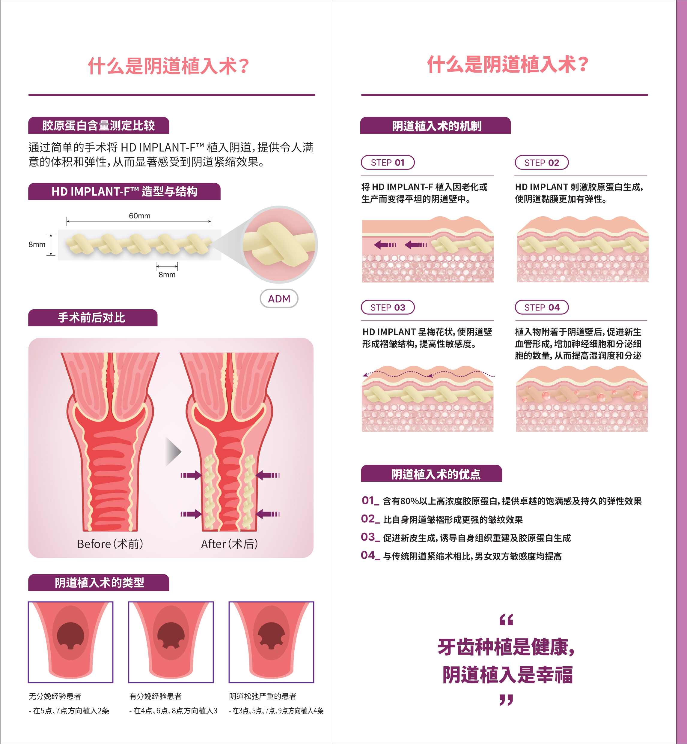 阴Գڪ 2