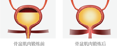 °ñ¹Ý±ÙÀ° ¿îµ¿ Àü°ú ÈÄ